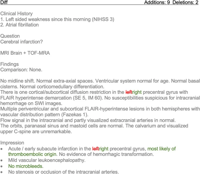 Example diff view